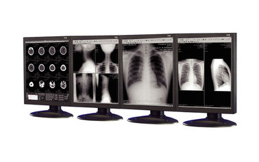 نمایشگرهای بازتابنده درجه پزشکی که در تجهیزات تصویربرداری پزشکی مورد استفاده قرار می گیرند