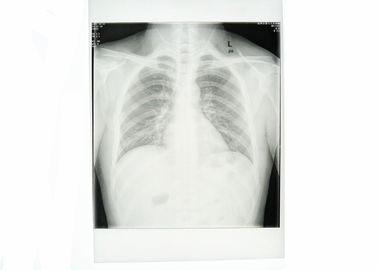 کاغذ پزشکی سفید قفسه سینه X ray فیلم ضد وضوح بالا